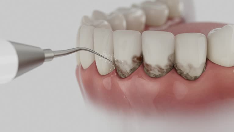 Reliable Emergency Dentist contractor in Azusa, CA by Smile Center Dentistry